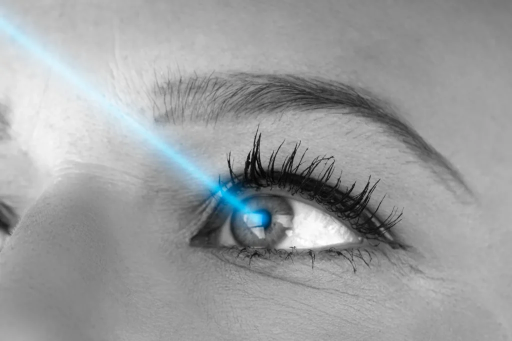 How Does SMILE Eye Surgery Differ From Traditional LASIK?